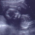 20 semanas de embarazo: rostro 20 semanas de embarazo: rostro