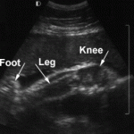 Embarazo 32 semanas: pierna, rodilla y pie Embarazo 32 semanas: pierna, rodilla y pie