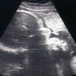 Embarazo 32 semanas: perfil Embarazo 32 semanas: perfil