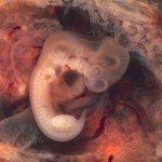 embrión - Euthamn(Flickr)