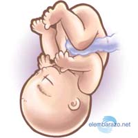 embarazo-32-semanas